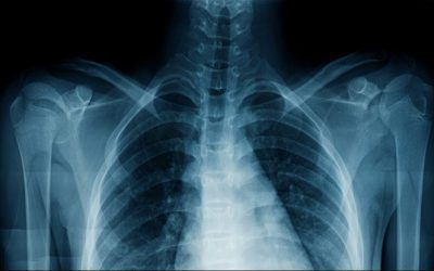 AI Can Predict People’s Race From X-Ray Images, And Scientists Are Concerned