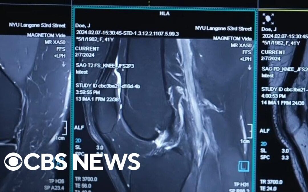 Innovative AI-enhanced MRI technology speeds up scans